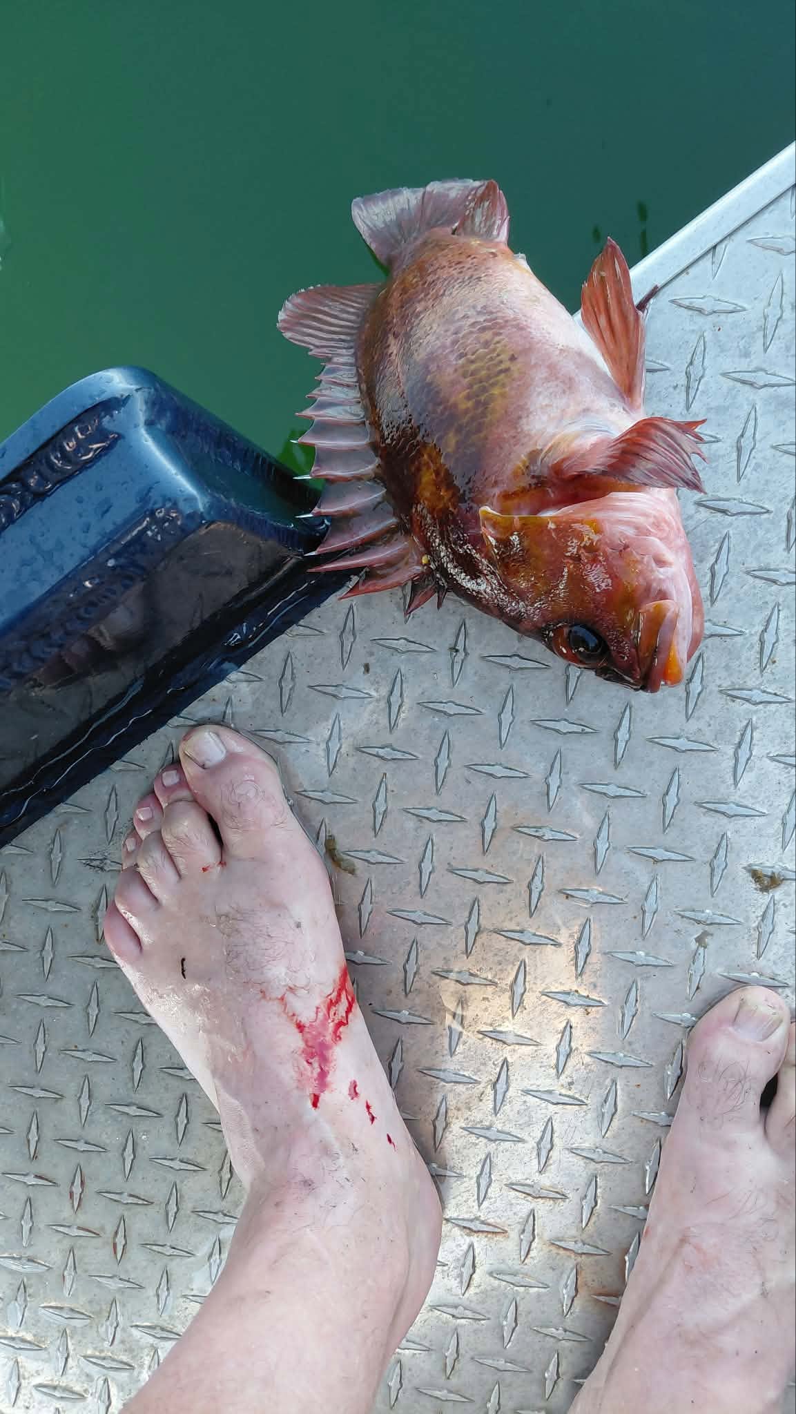 Rockfish Sting Treatment: Myths vs. Hot Water Bare foot with a bloody rockfish spine puncture wound next to a rockfish on a boat deck